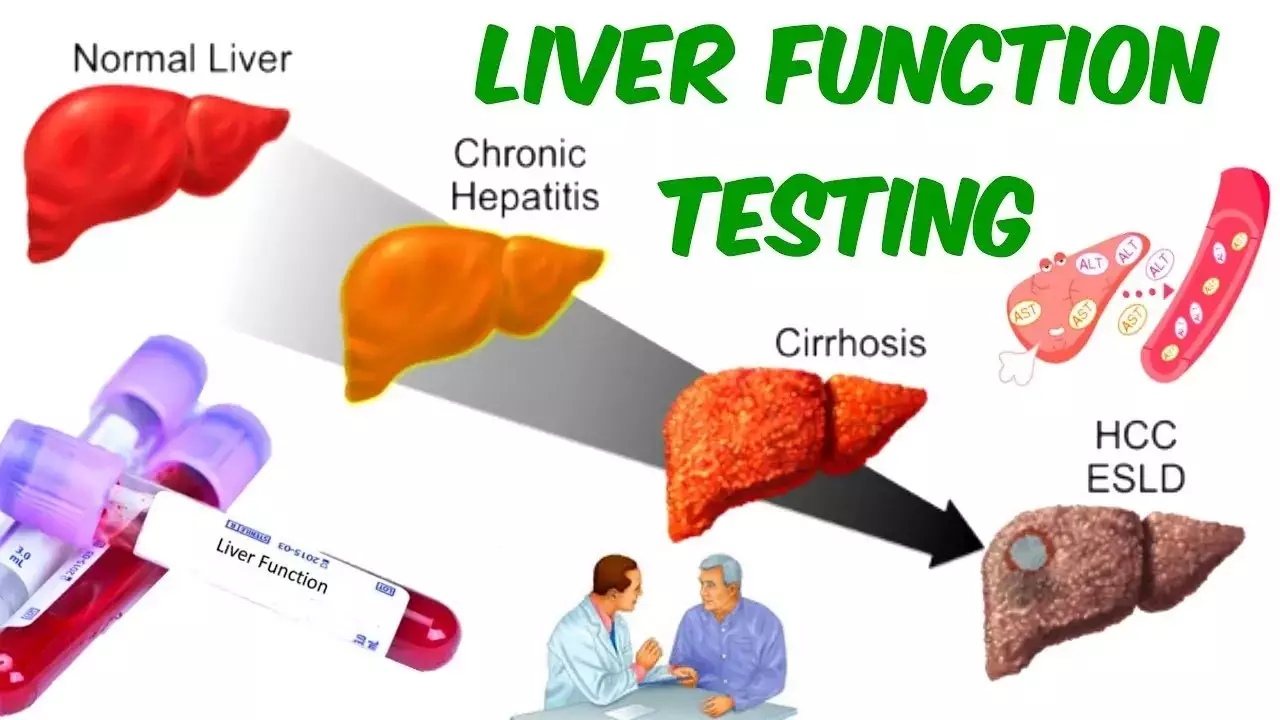 Liver Function Tests